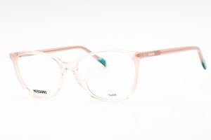 MIS 0155